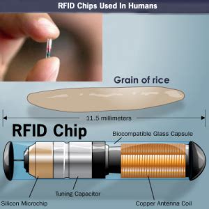 obamacare rfid chip|ObamaCare Implant: ObamaCare Microchip RFID Myth.